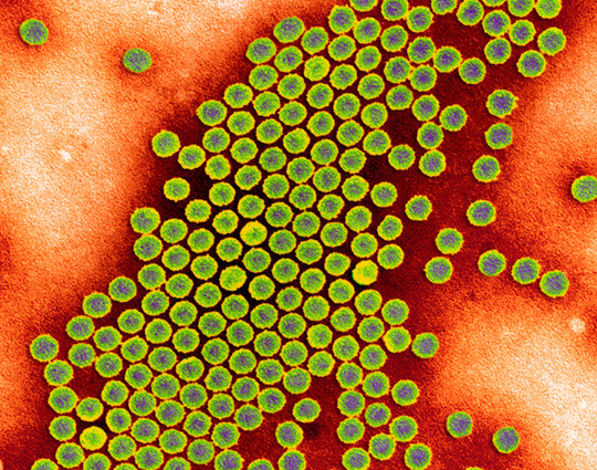 Illustrasjonsfoto &copy; Science Photo Library/NTB scanpix