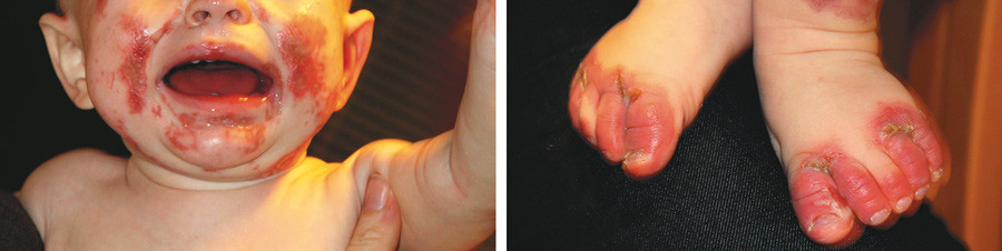 Foto: Jan Egil Romestrand