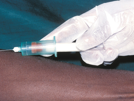 Illustrasjonsfoto: Science Photo Library