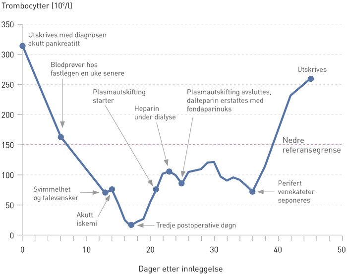 Figur 3  Trombocyttverdier fra f&oslash;rste utskrivning (dag 0) og frem til pasienten utskrives for tredje gang 45 dager senere