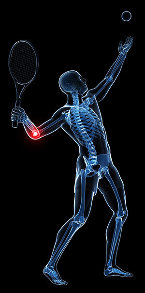 Illustrasjonsfoto: Science Photo Library