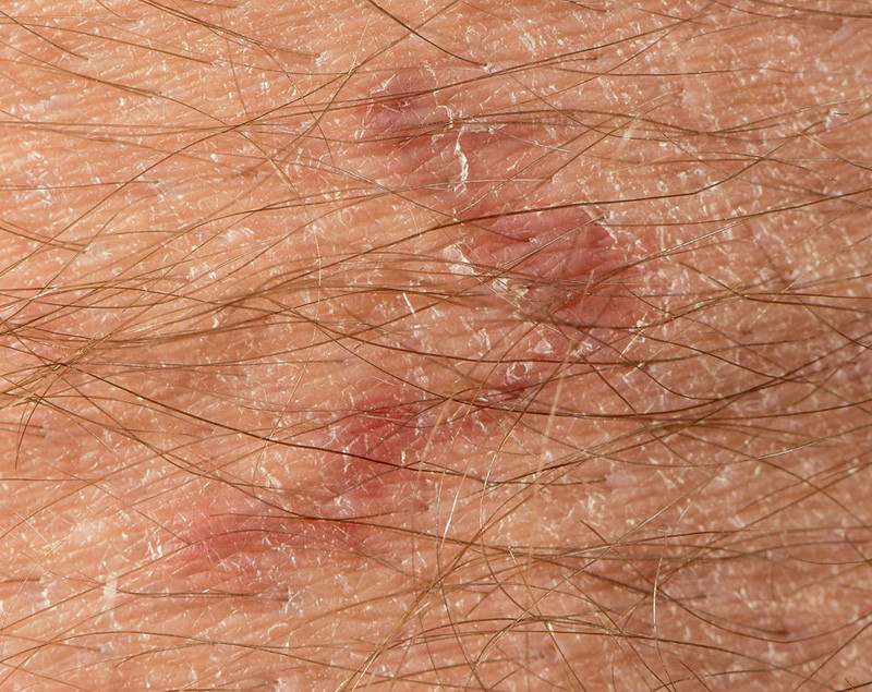 Foto: &Oslash;ystein H. Horgmo, Universitetet i Oslo