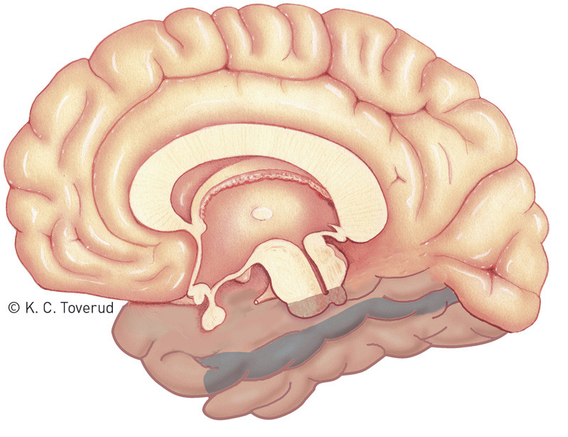 Figur 4  H&oslash;yre hemisf&aelig;re sett fra medialsiden, med temporallappens gyrus fusiformis avmerket i bl&aring;tt. fMR-studier har vist&hellip;