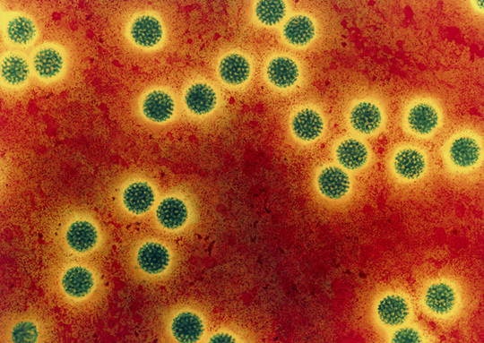 Farget elektronisk mikrofotografi (Coloured transmission electron micrograph, TEM) av rotavirus. Viruset har f&aring;tt navnet p&aring;&hellip;