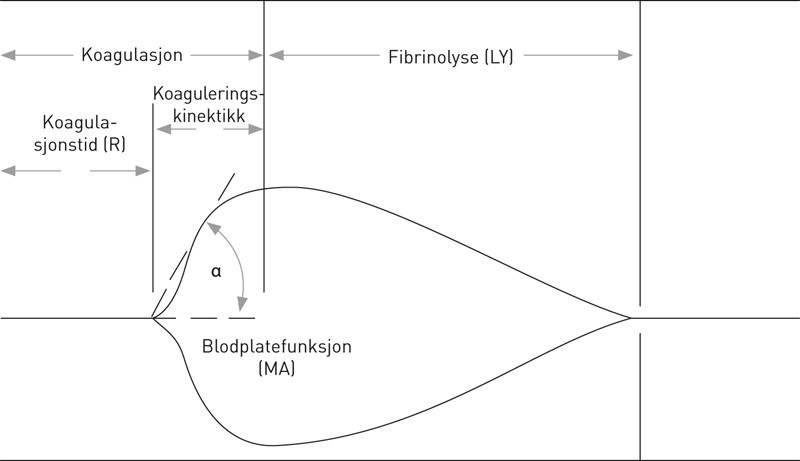 Figur 2  Variablene man skal vurdere i en tromboelastografikurve. Kurven har en dobbeltsidig fasong for &aring; forenkle&hellip;