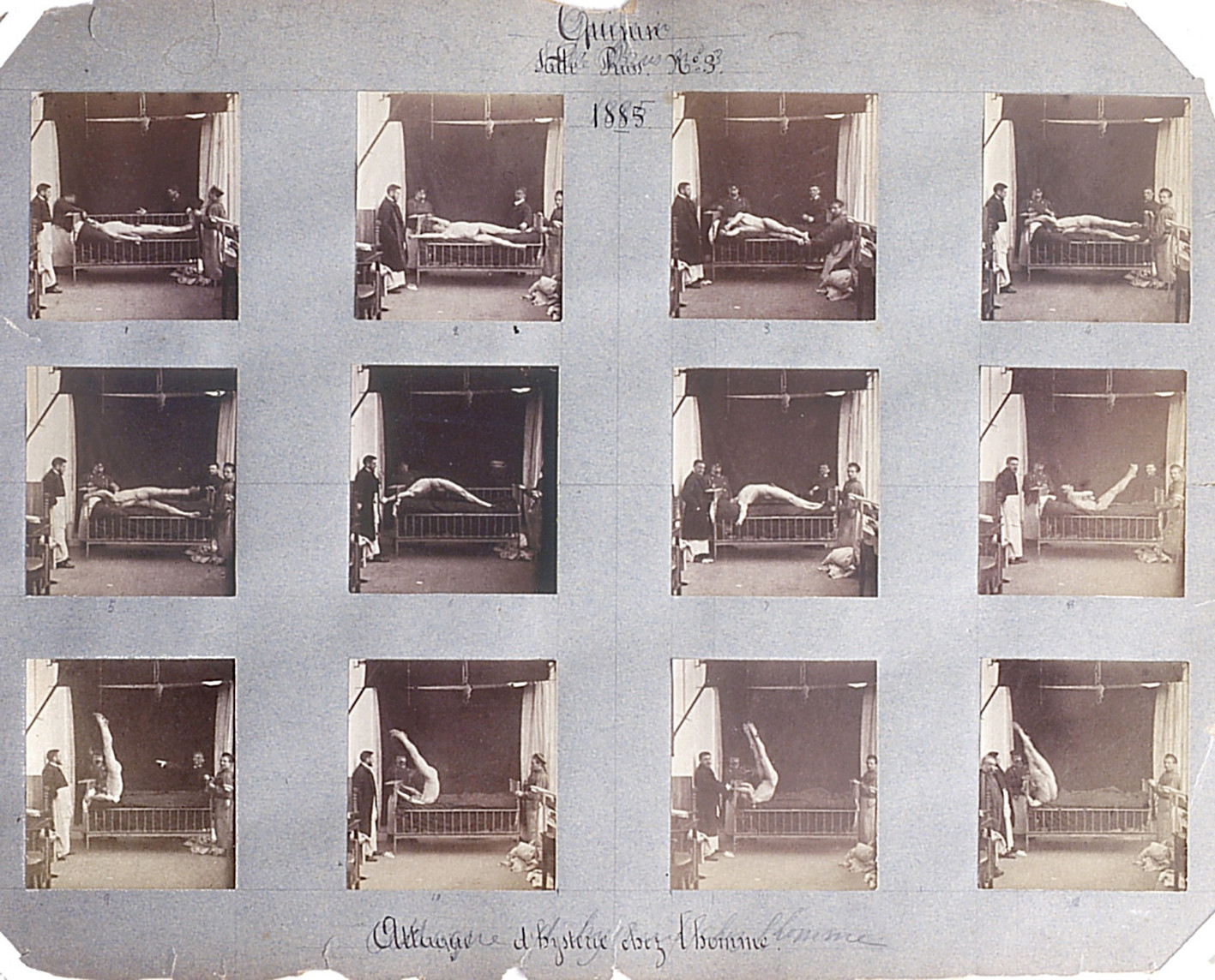 &laquo;Attaque d'hysterie chez l'homme&raquo; &ndash; fotoserie fra 1885 av en pasient ved La Salp&ecirc;tri&egrave;re-sykehuset i Paris. Foto: Albert Londe