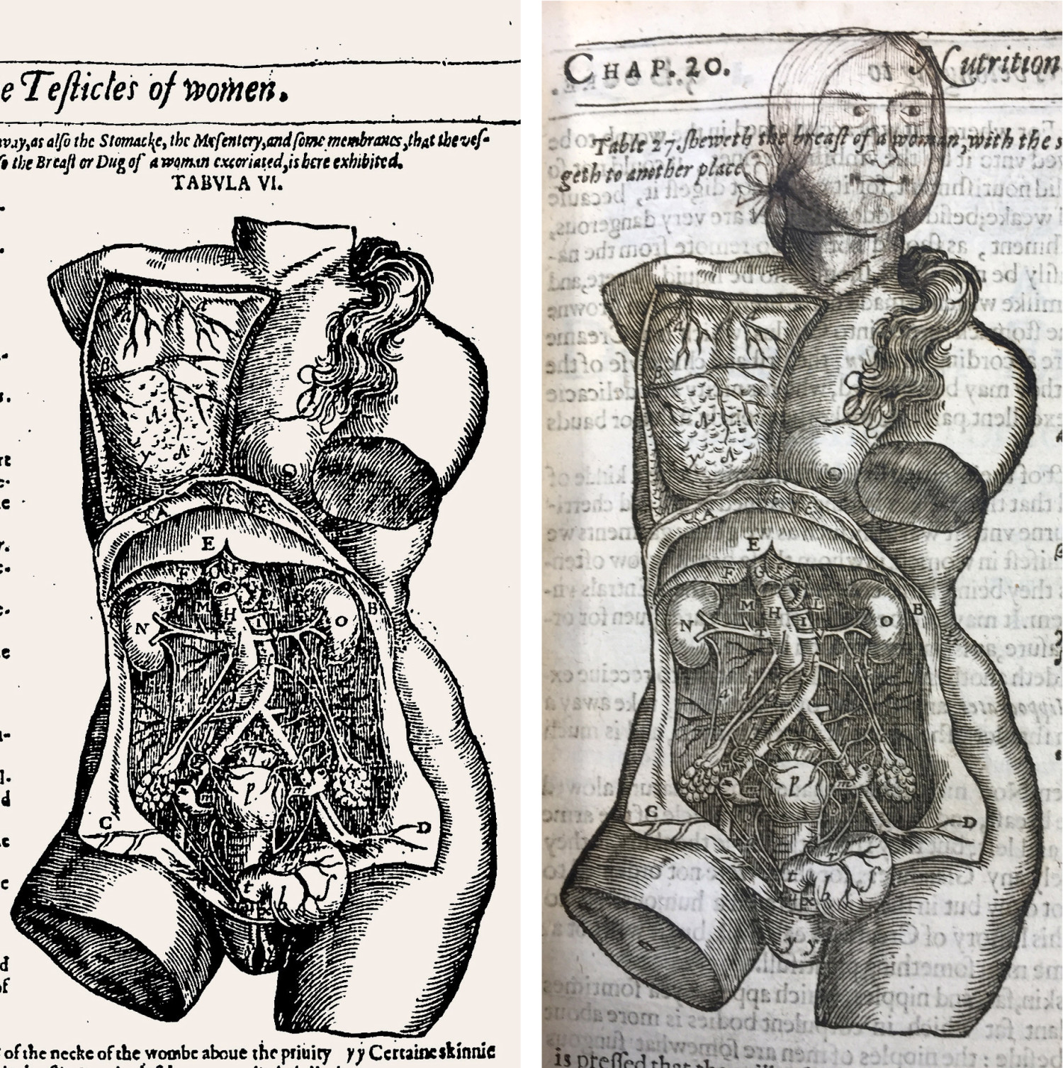Figur 1 Figuren viser en kvinnelig torso i to forskjellige utgaver av boken Mikrokosmographia: A Description of the Body of&hellip;