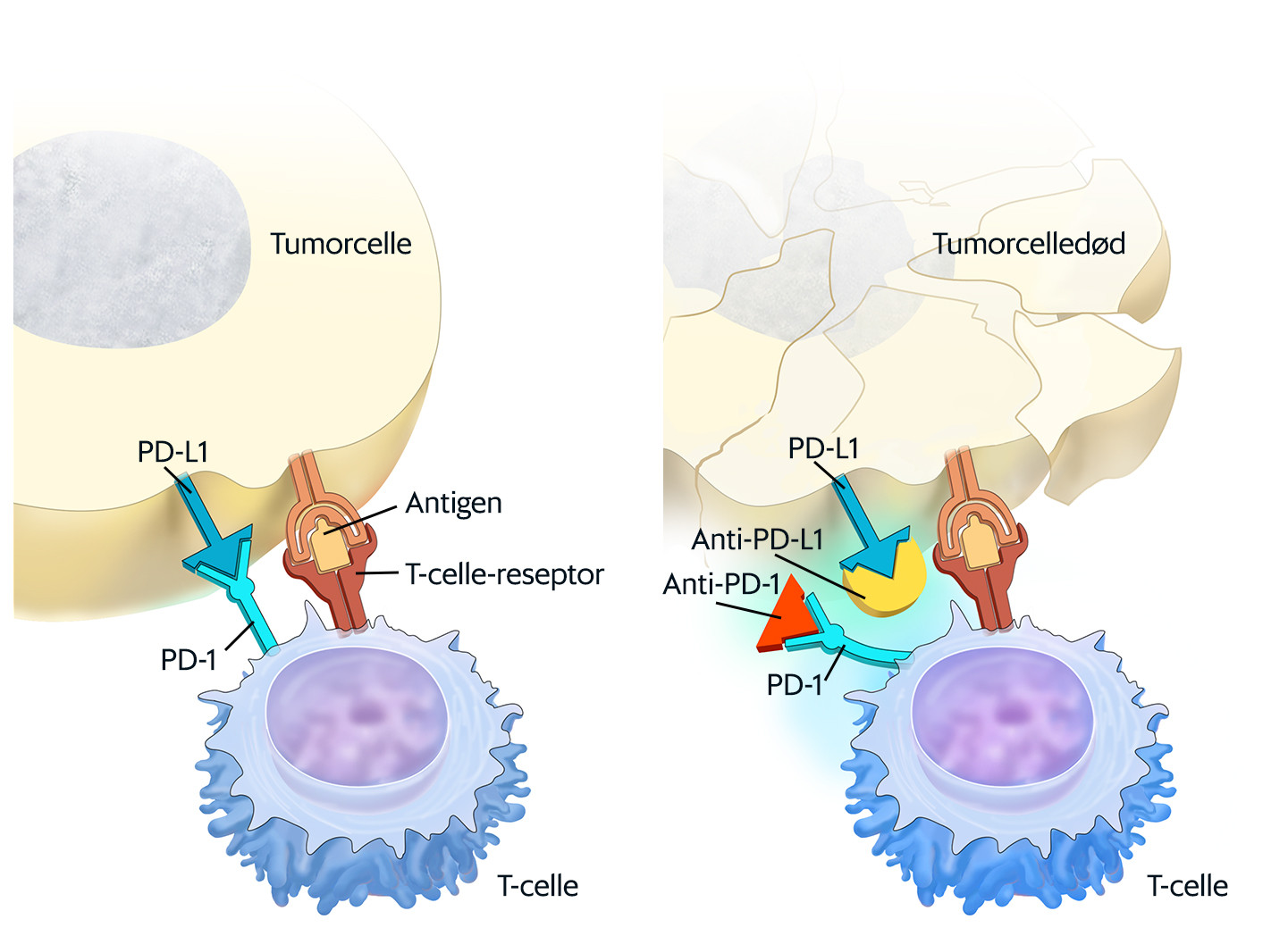 Figur 1 N&aring;r PD-L1 (programmert celled&oslash;d-ligand-1) p&aring; tumorcellen binder seg til PD-1-reseptoren (programmert celled&oslash;d-1&hellip;
