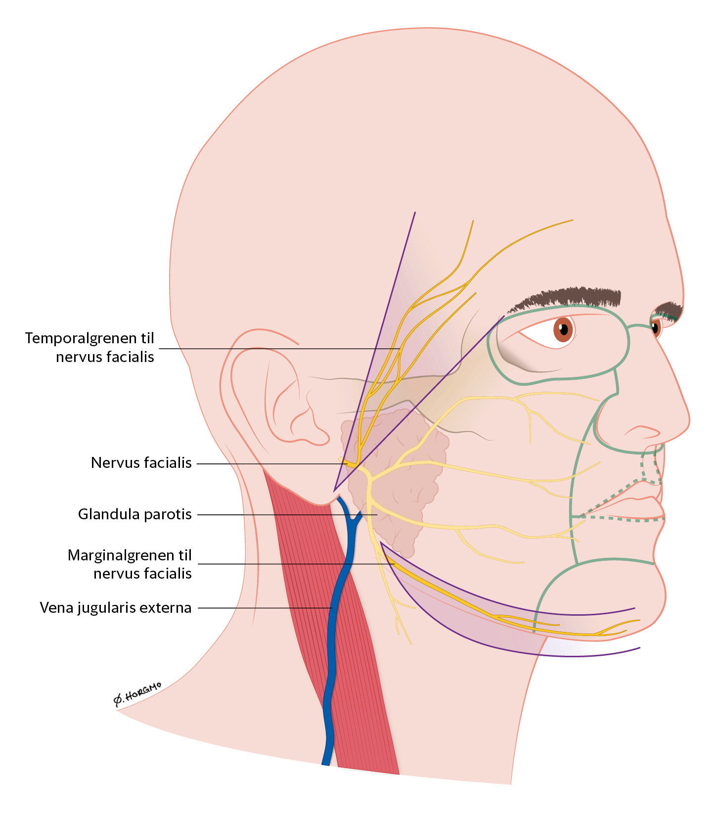 Figur 1 Temporalgrenen til nervus facialis, marginalgrenen til nervus facialis og vena jugularis externa. Grensene mellom&hellip;