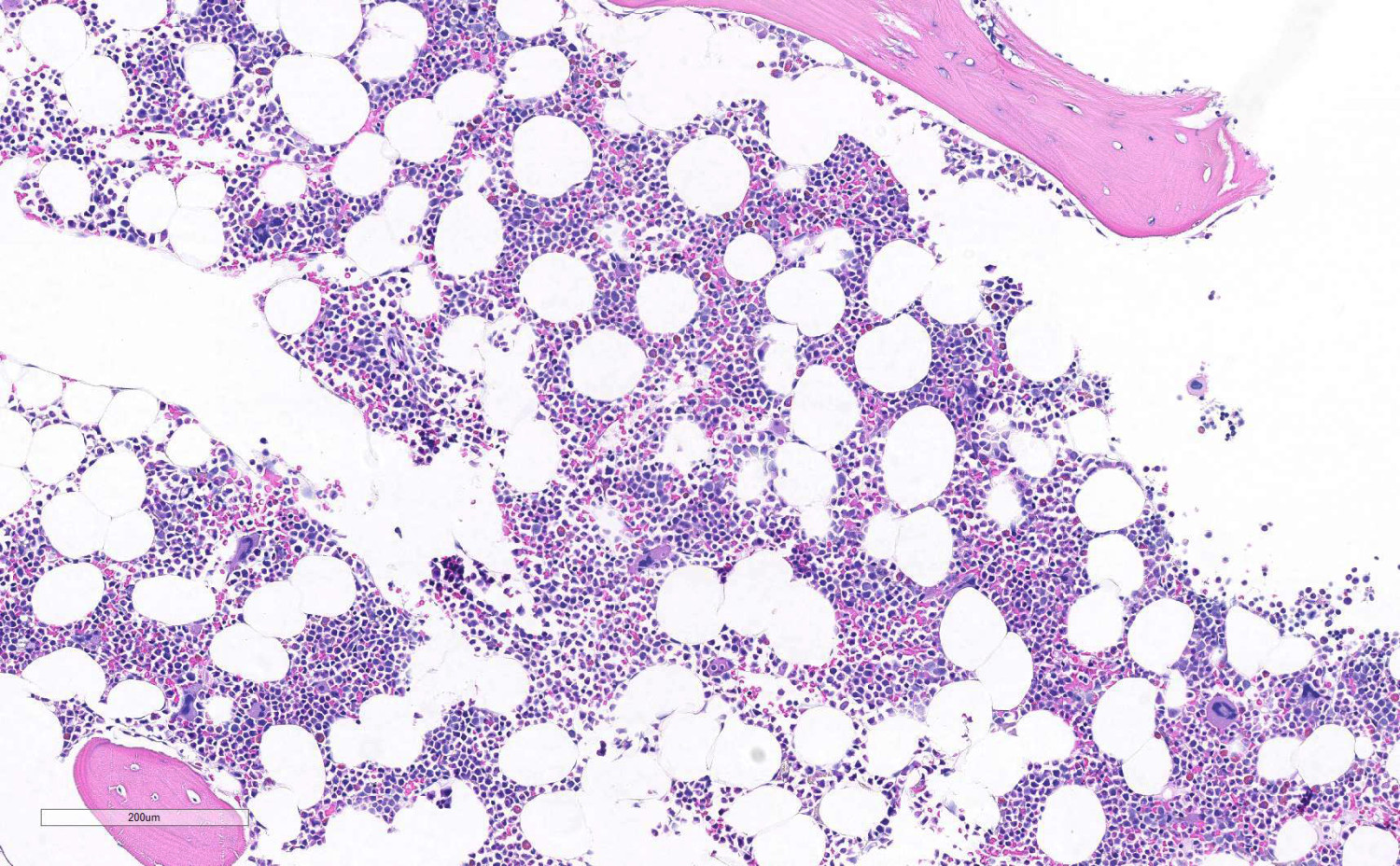Figur 1 Normocellul&aelig;r benmarg.
