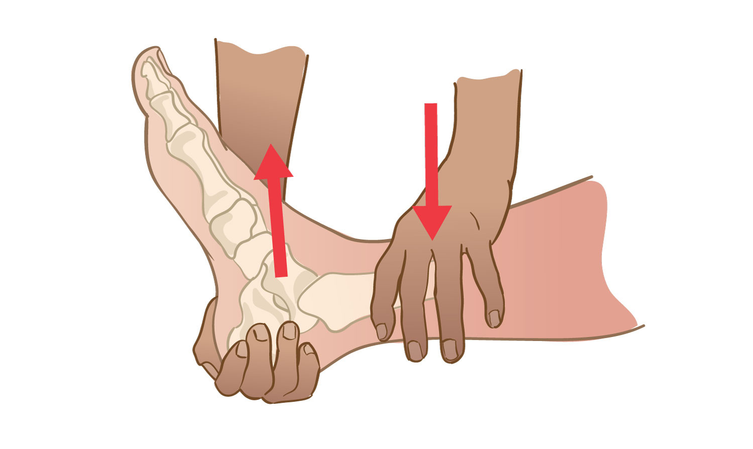 Figur 3 Fremre skuffetest. Med en h&aring;nd over distale fremre legg og en h&aring;nd bak calcaneus trekkes calcaneus og talus fremover&hellip;