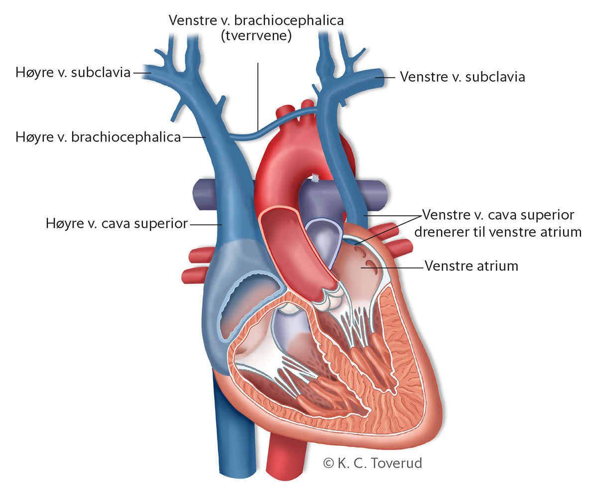 Figur 5 V&aring;r pasients anatomi.