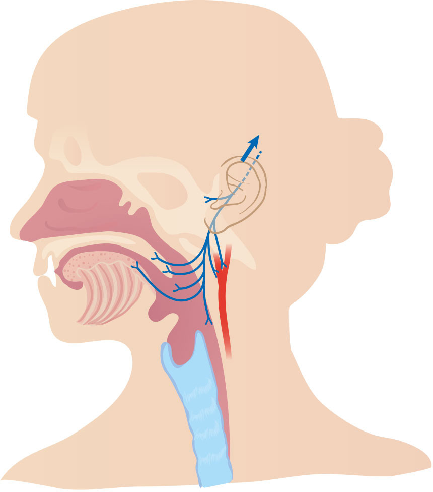 Figure 2 The glossopharyngeal nerve receives sensory fibres from the pharynx, auditory tube, middle ear, posterior part of&hellip;