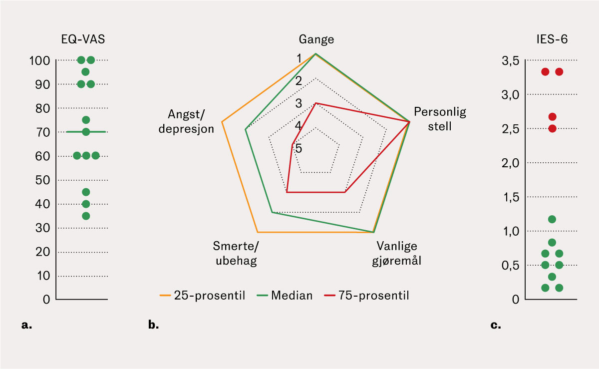 Figur 1 Livskvalitet og posttraumatisk stress m&aring;lt 15&nbsp;m&aring;neder etter intensivopphold hos 13 gravide med akutt&hellip;