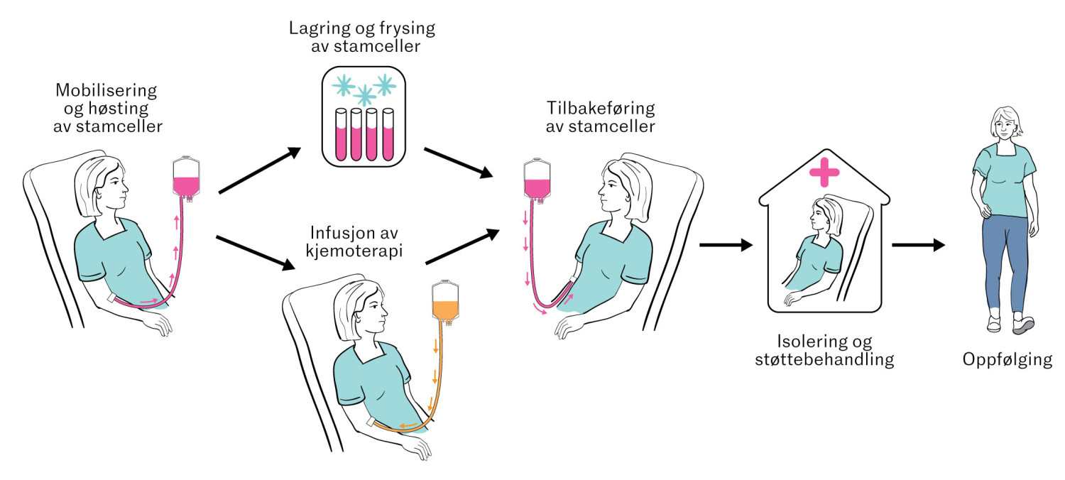 Figur 1 Stamcellebehandling ved multippel sklerose