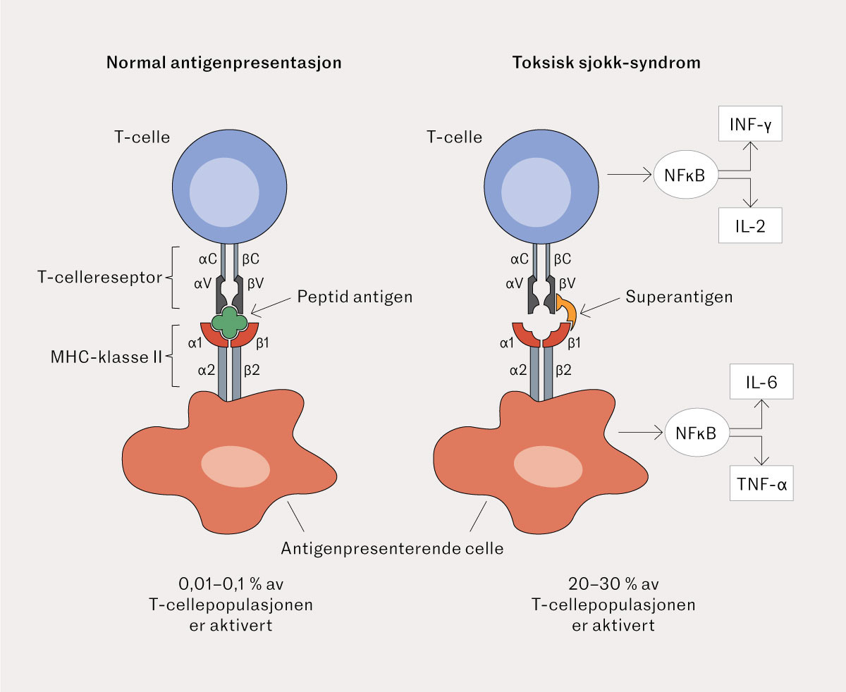 Figur 2 Skjematisk oversikt over normal T-celleaktivering og abnormal T-celleaktivering indusert av et superantigen &hellip;