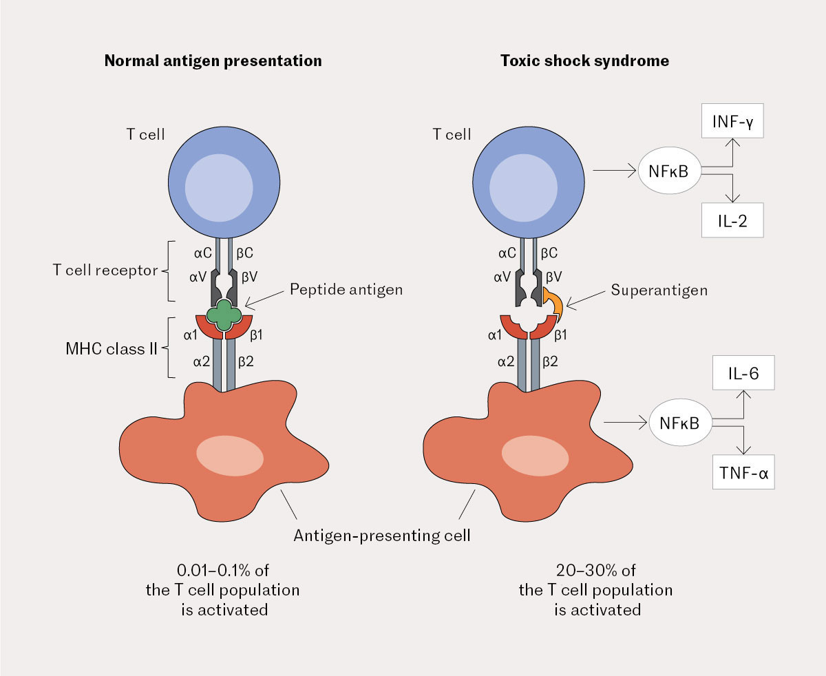 Figure 2 Schematic overview of normal T-cell activation and abnormal T-cell activation induced by a superantigen (reproduced&hellip;