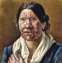 Omtrent samtidig med statistikkens inntreden i medisinen skjer det ogs&aring; forandringer p&aring; et annet plan: medisinen blir en&hellip;