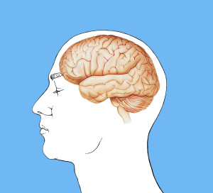 Illustrasjon: MedicalArtInc/iStock, endret av Tidsskriftet