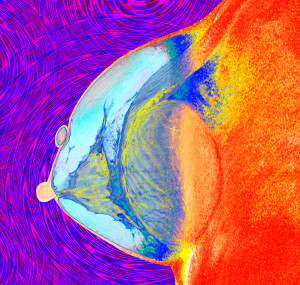 Illustrasjonsfoto: Science Photo Library / NTB Scanpix