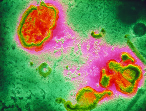 Virioner fra respiratorisk syncytialvirus. Illustrasjonsfoto: Science Photo Library / NTB