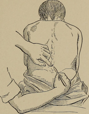 Illustrasjon: Science Photo Library / NTB