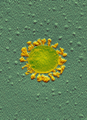 Farget transmisjonselektronmikroskopbilde av koronaviruset SARS-CoV-2. Illustrasjon: Science Photo Library / NTB
