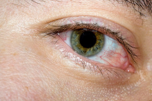 Illustrasjonsfoto: SpeedliteModifier/iStock. Tilpasset av Tidsskriftet