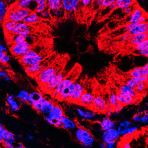 Illustrasjonsfoto: Science Photo Library / NTB