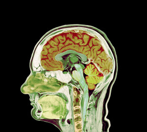 Illustrasjonsfoto: Science Photo Library / NTB