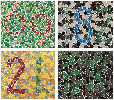 Figur 2  Eksempler p&aring; pseudoisokromatiske tavler. Personer med defekt fargesans vil ikke kunne lese de benyttede testtall og&hellip;