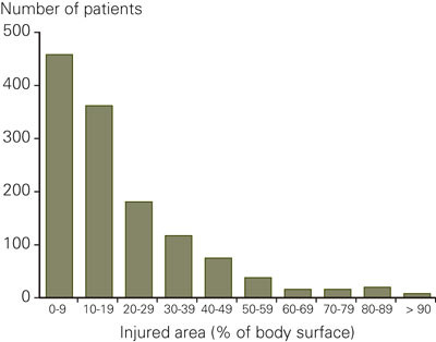 Figure 2  Number of patients 1984&thinsp;-&thinsp;2004, by injured skin area