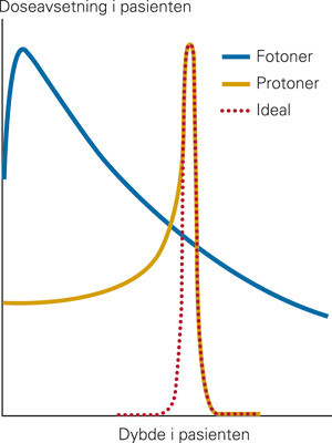 Doseavsetningen innover i en pasient ved tradisjonell str&aring;lebehandling (fotoner) og protonterapi. Mens doseavsetningen fra&hellip;