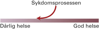 Figur 2  Evnebasert sykdomsbegrep. Med utgangspunkt i helsedimensjonen, som l&oslash;per fra d&aring;rlig til god, defineres sykdom som&hellip;