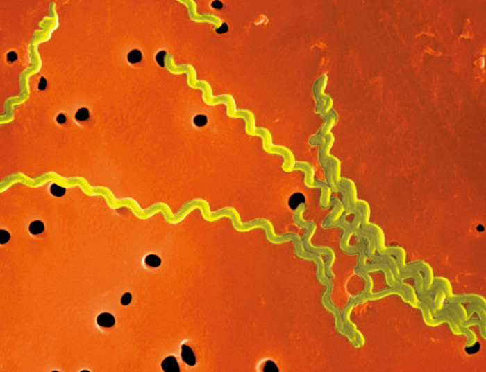 Figure 1  Leptospira interrogans. Electron microscopy. Photo T. Carvalho/Visuals Unlimited/Corbis/Scanpix