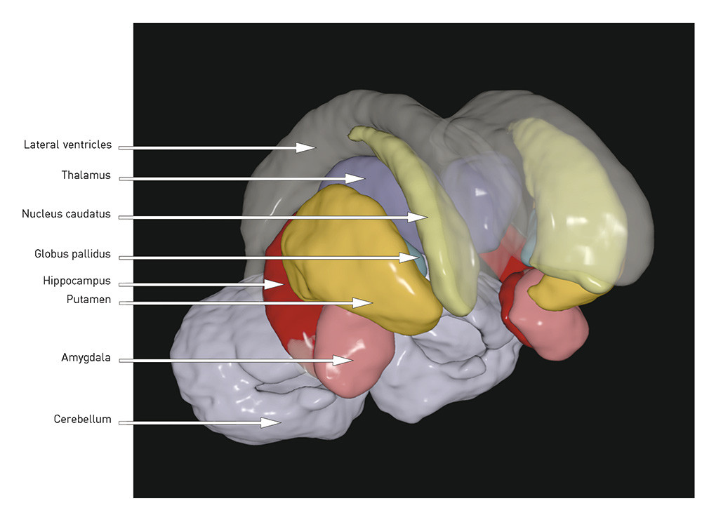 Fig. 2  Three-dimensional illustration of subcortical structures based on a template from the MRI post-processing tool&hellip;