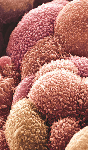 Illustrasjonsfoto Science Photo Library/NTB scanpix