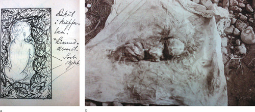 Figure 3  a) Drawing of a child&rsquo;s corpse found in a suitcase in the accused&rsquo;s room in winter. The corpse was frozen and had&hellip;