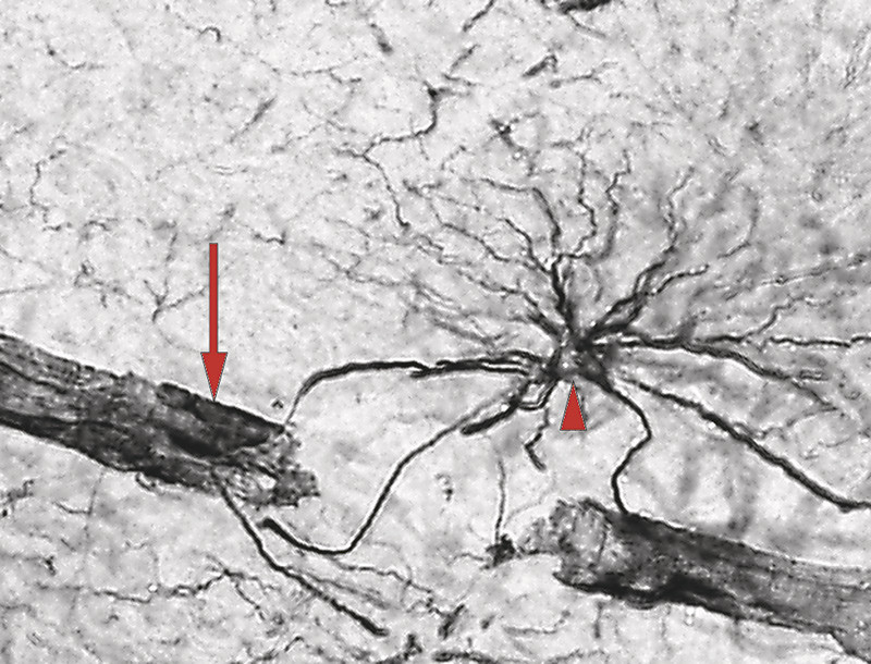 Figure 2  Astrocyte extending processes towards the brain parenchyma and blood vessels. Immunohistochemical visualisation of&hellip;