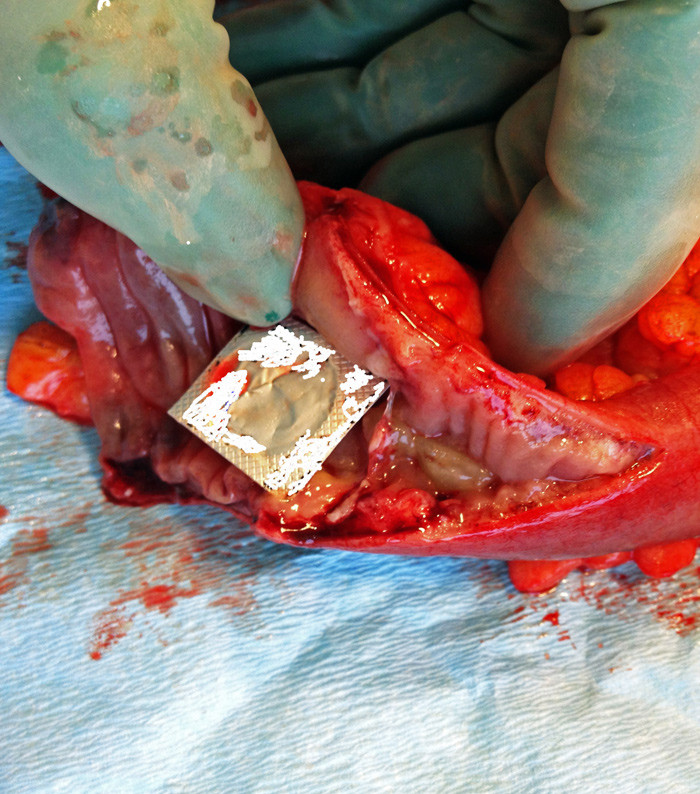 Figure 3  Photo of tablet in blister pack (retouched to avoid identification of the brand) in opened small intestine, with&hellip;