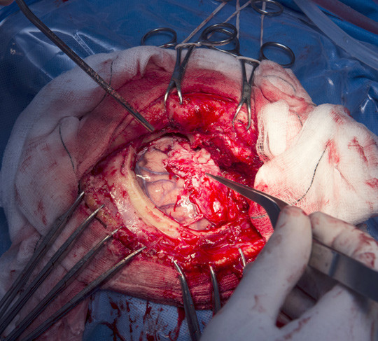 Illustrasjonsfoto: Sciencephoto/NTB scanpix