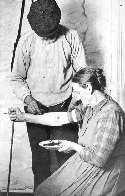 Figure 3  Bloodletting in V&auml;rmland, Sweden, 1918. Bloodletting was used as a cure for epilepsy. Drinking human or animal&hellip;