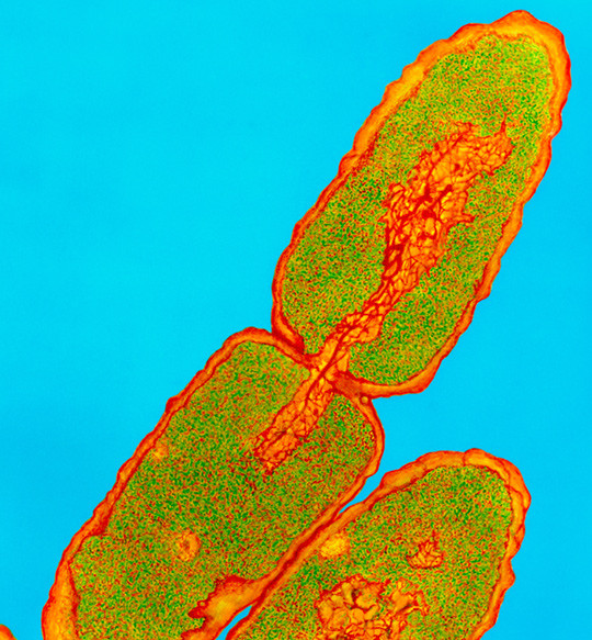 Salmonella typhimurium bacteria. Illustrasjonsfoto: Sciencephoto/NTB scanpix