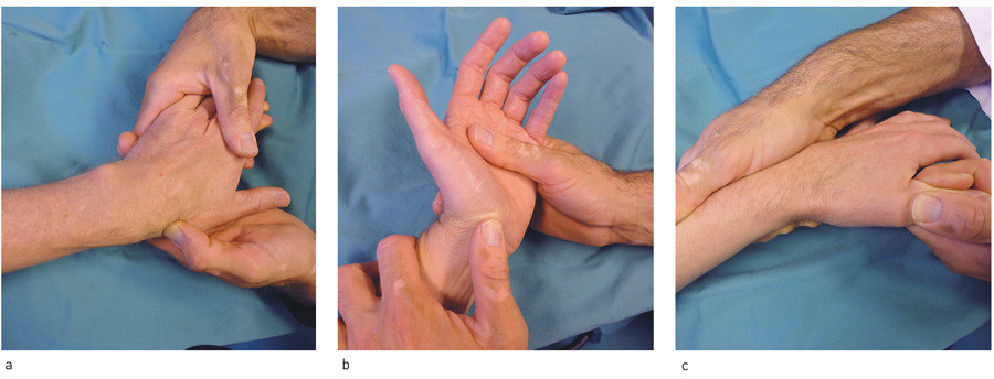 Figure 1  Clinical examination of suspected scaphoid fracture. a) Palpation of scaphoid in the &laquo;snuff box&raquo; with ulnar&hellip;