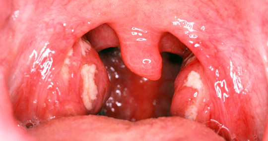 Illustrasjonsfoto: Science Photo Library