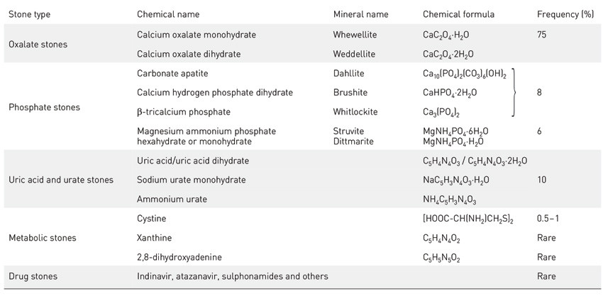 Table 1  Common and important chemical substances and mineral components in kidney stones and their estimated frequencies.
