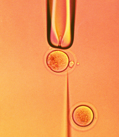 Illustrasjonsfoto: Science Photo Library