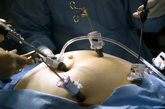 Illustrasjonsfoto: Science Photo Library