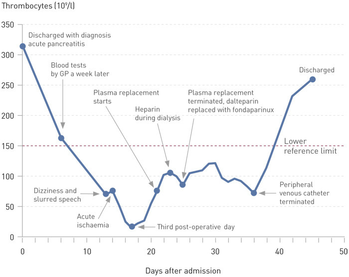 Figure 3  Thrombocyte values from initial discharge (Day 0) and until the patient is discharged for the third time, 45 days&hellip;
