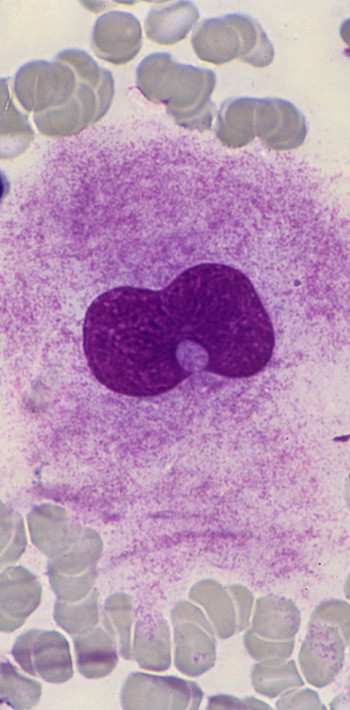 Illustrasjonsfoto: Science Photo Library